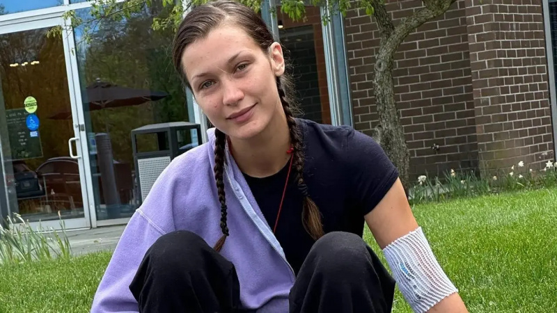 Bella Hadid sentada na grama com um curativo no braço